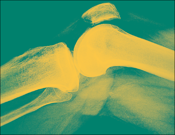 orthopedics-ortho-capital